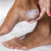 In this close-up photo of a woman's feet, her hand is applying lotion to one heel.