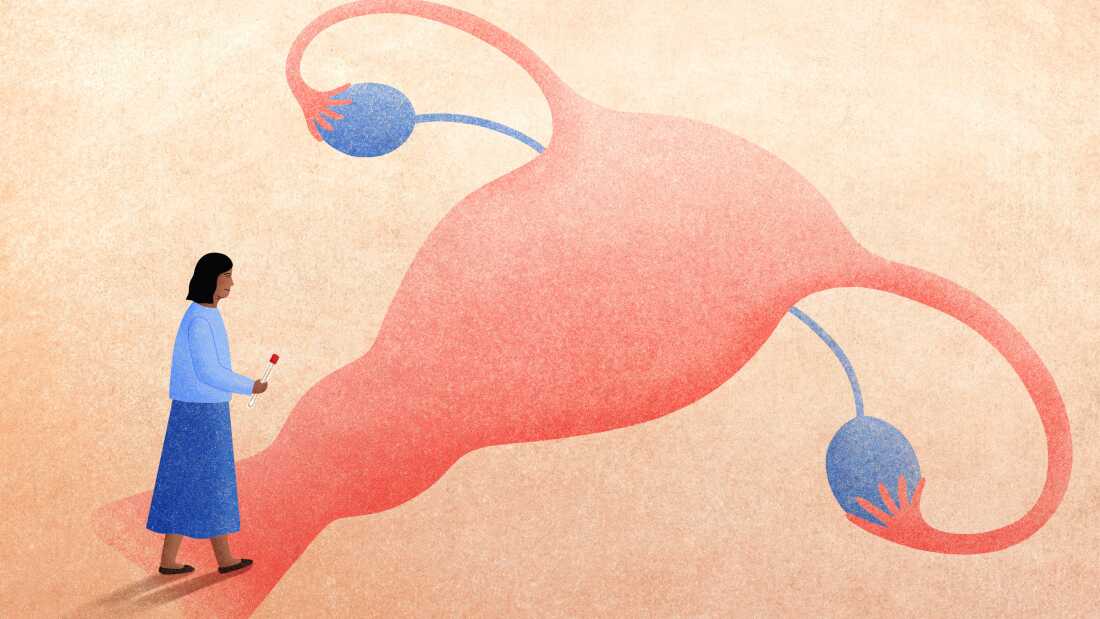 A woman considers her options for cervical cancer screening