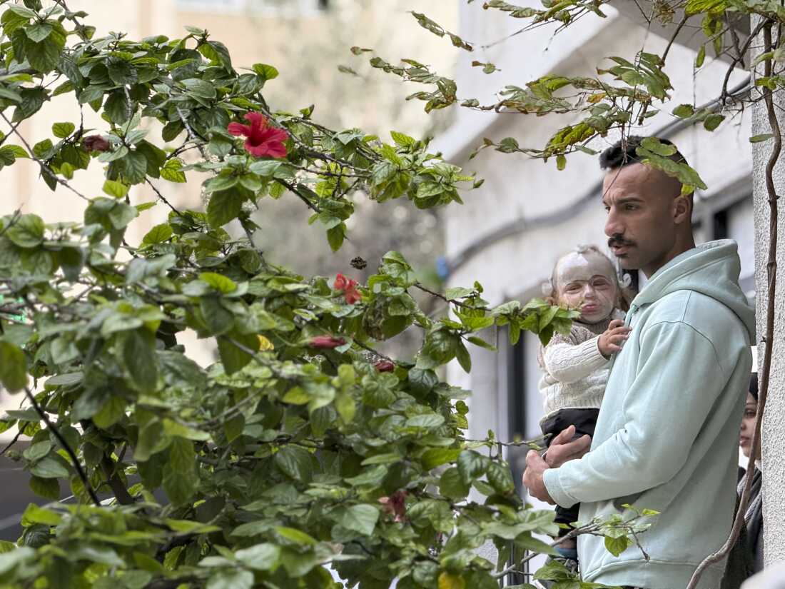 A Palestinian man wounded in the war sits near a stationary bike used for physiotherapy at MSF’s clinic in Gaza City on Dec. 31, 2025.